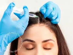 Mesoterapia Capilar: La Innovación que Revoluciona el Cuidado del Cabello en Málaga